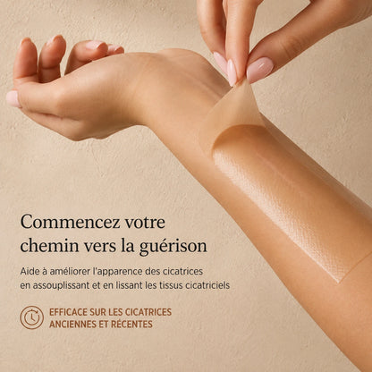 Application de la bande silicone Anouvia sur le bras — lisse et assouplit les tissus cicatriciels